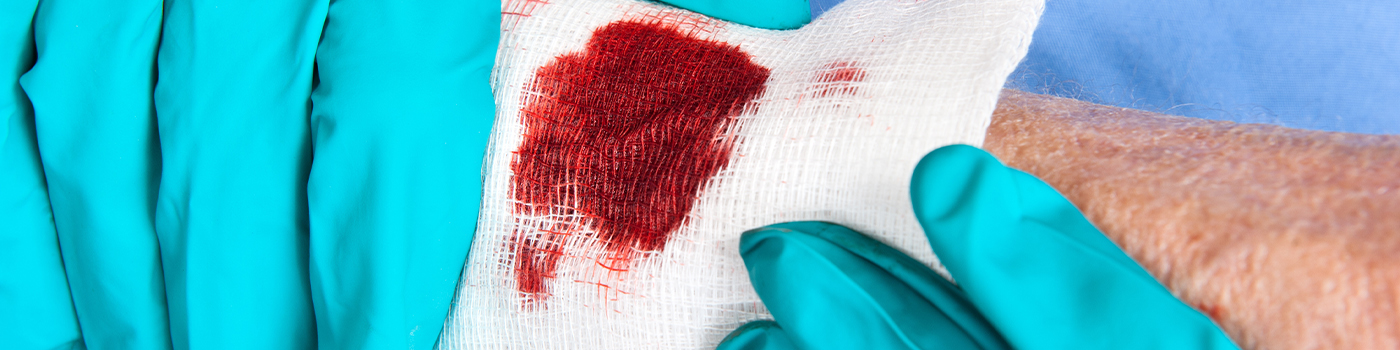 Our Services-Skin Traumatic Tears